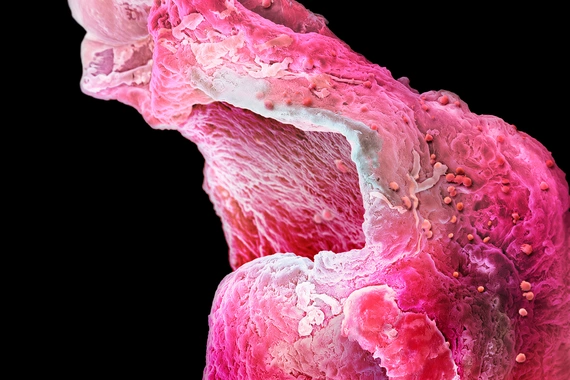 High resolution picture of an artificial heart muscle from a research lab in Cambridge. High resolution picture of an artificial heart muscle from a research lab in Cambridge.
